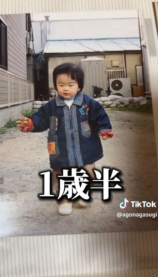小哥超长鞋拔子下巴火了！去拍X光医生都惊了，新人类？（组图） - 7