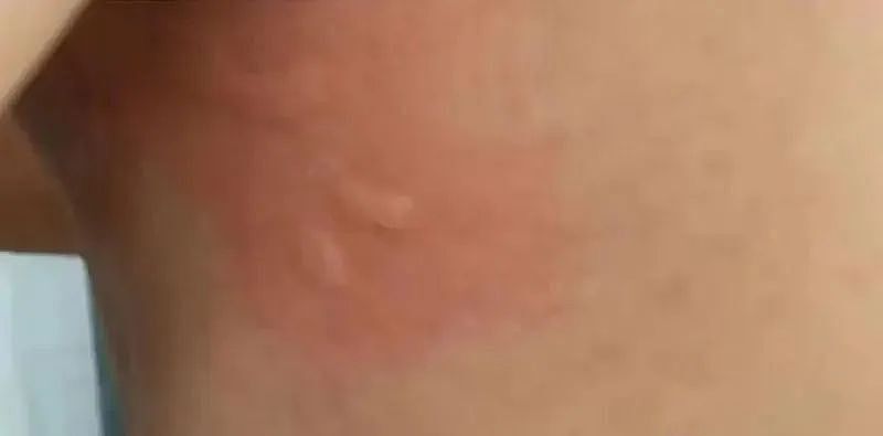 网红徒手捡“绝命毒师”上热搜！赶海时，这些“美丽杀手”千万别碰（组图） - 8