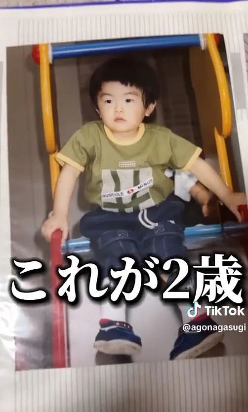 小哥超长鞋拔子下巴火了！去拍X光医生都惊了，新人类？（组图） - 8