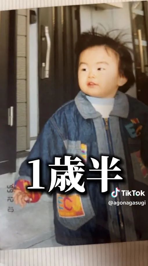 小哥超长鞋拔子下巴火了！去拍X光医生都惊了，新人类？（组图） - 6