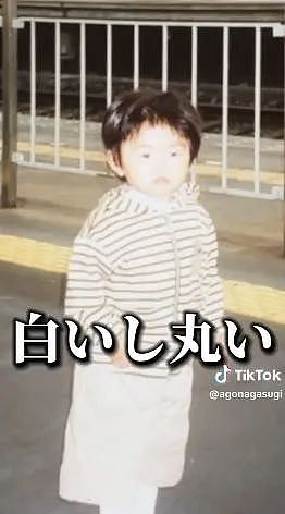 小哥超长鞋拔子下巴火了！去拍X光医生都惊了，新人类？（组图） - 9