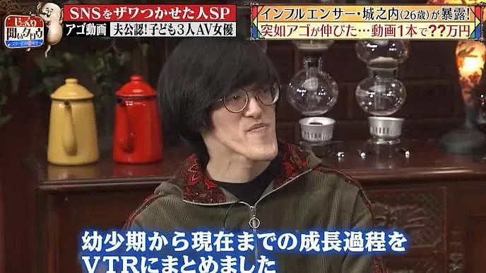 小哥超长鞋拔子下巴火了！去拍X光医生都惊了，新人类？（组图） - 14
