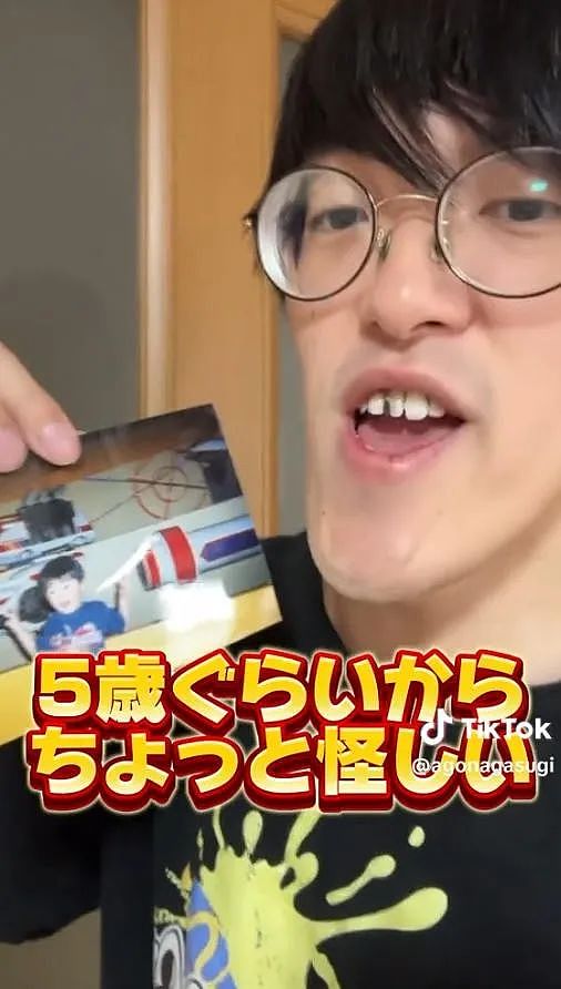 小哥超长鞋拔子下巴火了！去拍X光医生都惊了，新人类？（组图） - 12