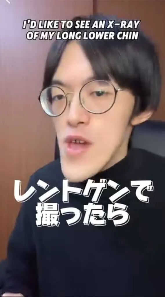 小哥超长鞋拔子下巴火了！去拍X光医生都惊了，新人类？（组图） - 15