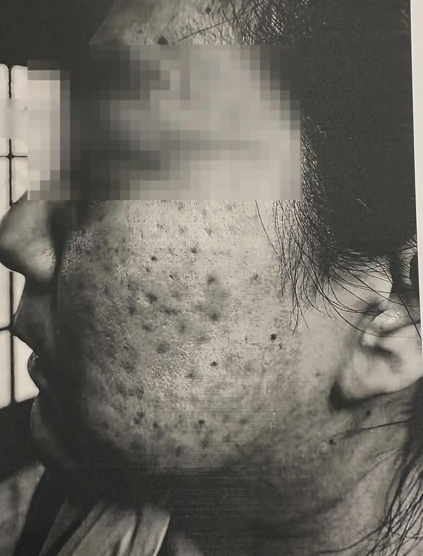 女子在医生家中做医美致十级伤残,法院:医生全责(组图) - 1
