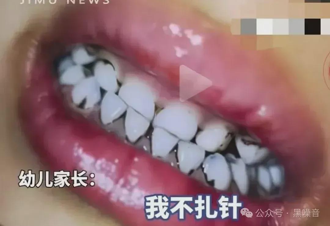 天水儿童铅中毒事件:还要付出多少“代价”才够?(组图) - 1