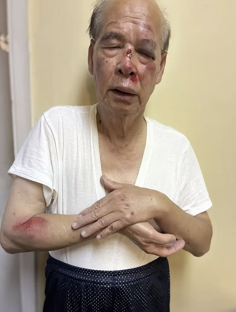 93岁知名侨领被女贼抢劫拖行！南加治安再亮红灯（组图） - 1