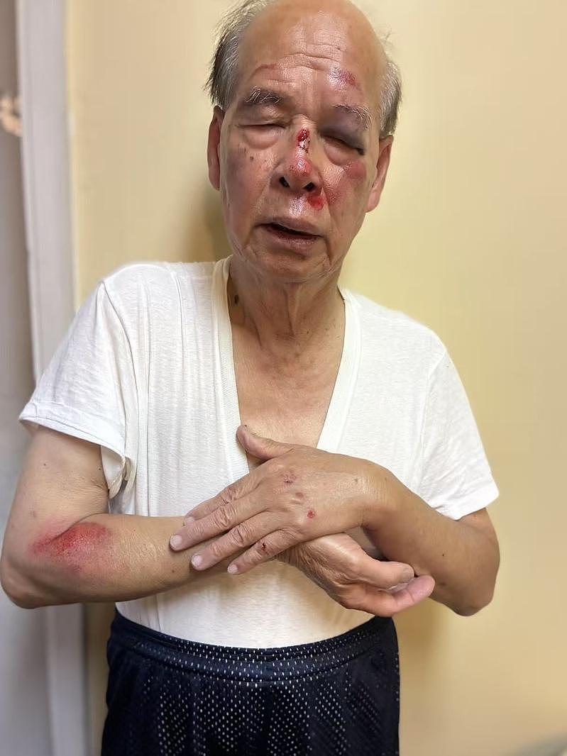93岁知名侨领，超市外遭劫匪残忍拖行（图） - 1