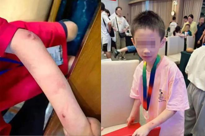 围棋少年坠亡父亲不认可“自杀”:警方最初认定意外坠楼(组图) - 8