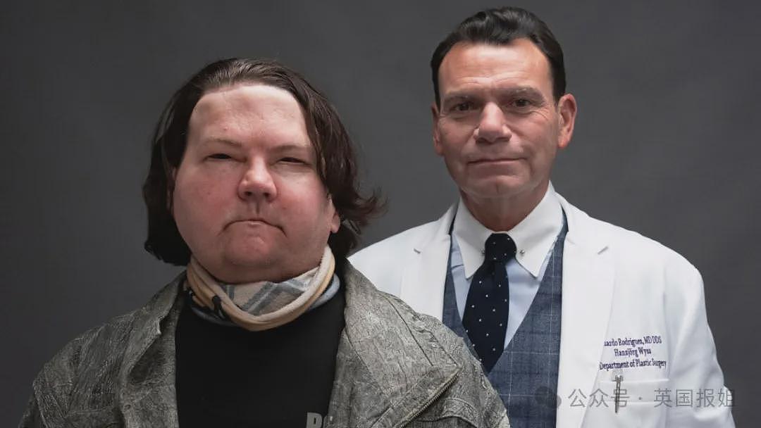 全球首例移植全脸手术男子结婚！车祸毁容换脸后拍视频爆红，网恋美女护士成功（组图） - 7