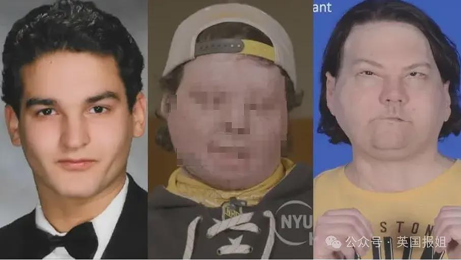 全球首例移植全脸手术男子结婚！车祸毁容换脸后拍视频爆红，网恋美女护士成功（组图） - 1