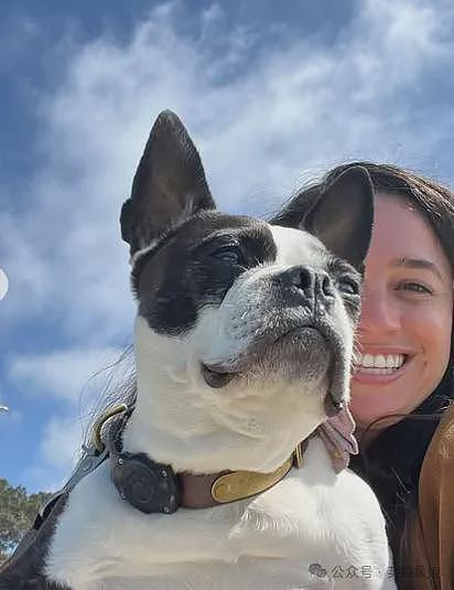 全球首例移植全脸手术男子结婚！车祸毁容换脸后拍视频爆红，网恋美女护士成功（组图） - 13
