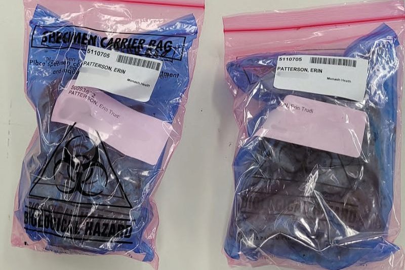墨尔本毒蘑菇谋杀案中用来定罪的关键证据（视频/组图） - 2