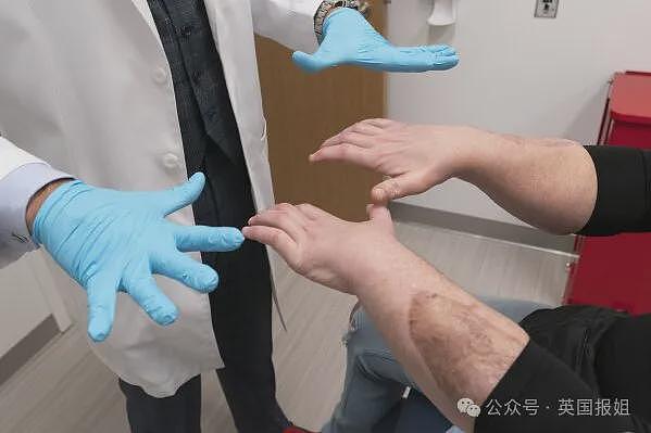 全球首例移植全脸手术男子结婚！车祸毁容换脸后拍视频爆红，网恋美女护士成功（组图） - 9