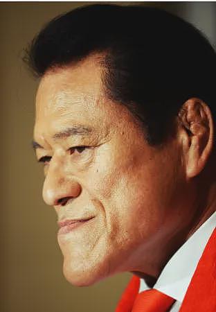 外国小哥超长鞋拔子下巴火了!一照X光吓坏医生:这还是人类吗(组图) - 9