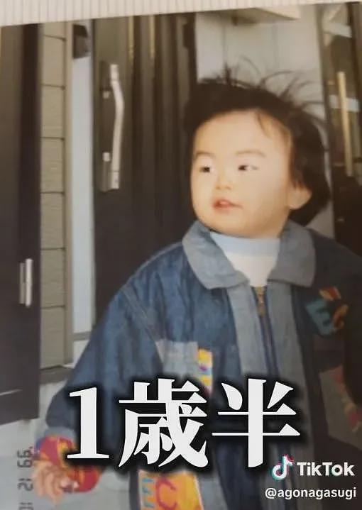 外国小哥超长鞋拔子下巴火了!一照X光吓坏医生:这还是人类吗(组图) - 3