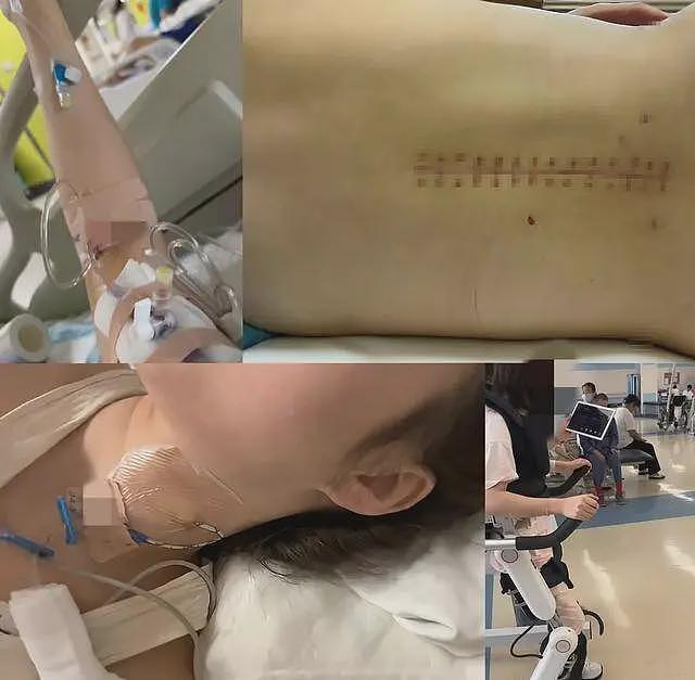 男子开车致女友截瘫后续！女方黑历史被扒，把男生当备胎，本人回应（组图） - 2