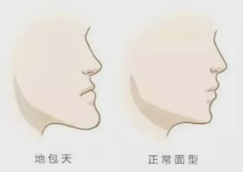 外国小哥超长鞋拔子下巴火了!一照X光吓坏医生:这还是人类吗(组图) - 15