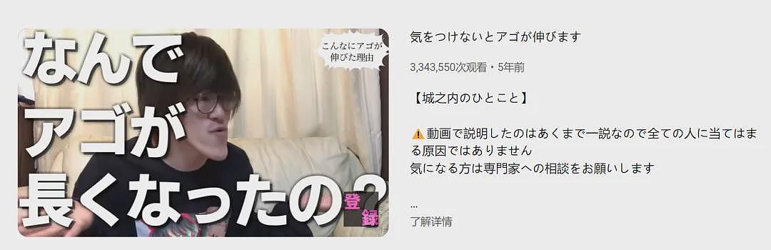 外国小哥超长鞋拔子下巴火了!一照X光吓坏医生:这还是人类吗(组图) - 2