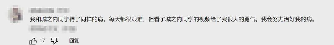外国小哥超长鞋拔子下巴火了!一照X光吓坏医生:这还是人类吗(组图) - 13