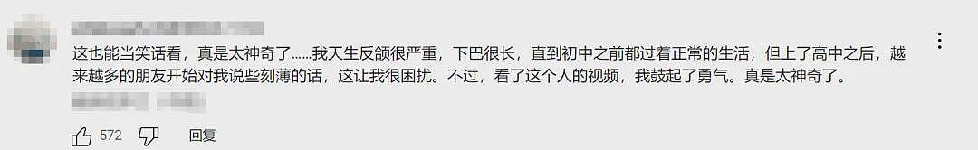 外国小哥超长鞋拔子下巴火了!一照X光吓坏医生:这还是人类吗(组图) - 12
