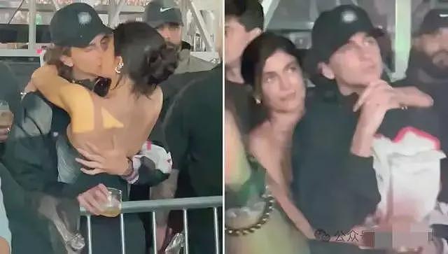 卡戴珊家的金小妹承认隆胸，曝光整形过程，面对粉丝追捧坦言很后悔（组图） - 23