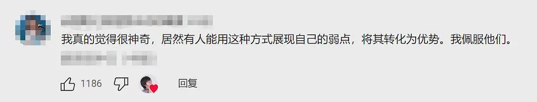 外国小哥超长鞋拔子下巴火了!一照X光吓坏医生:这还是人类吗(组图) - 14