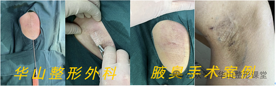 女子因这个生理特征被辞退！很多人有此尴尬困扰，难以启齿！网友吵翻（组图） - 15