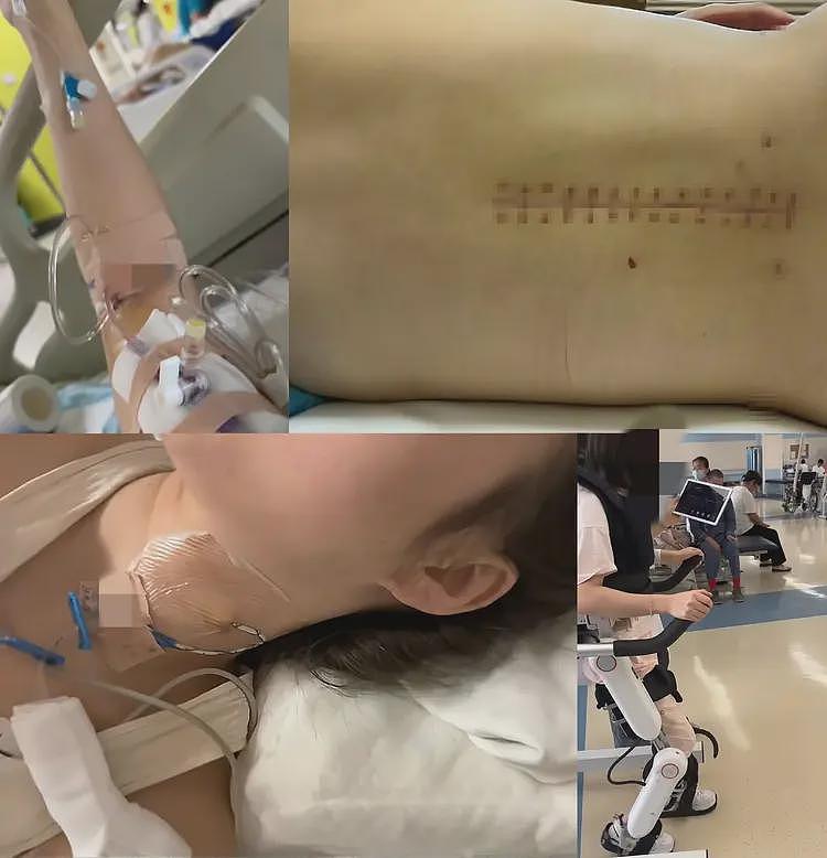反转！瘫痪女被抛弃后续，把男友当备胎，黑历史被扒，果然不简单（组图） - 2