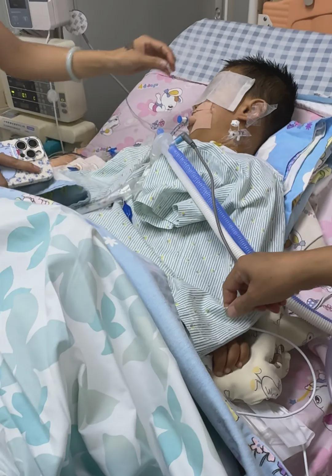3岁男童做这种小手术后脑死亡！医院：手术监控已覆盖不可见，母亲：多次想转院被拒（组图） - 1