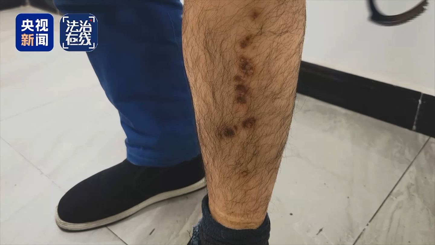 关铁笼、剁手指、强迫卖淫…央视揭缅北白家残忍虐待手段,有一套完整惩戒体系(组图) - 8