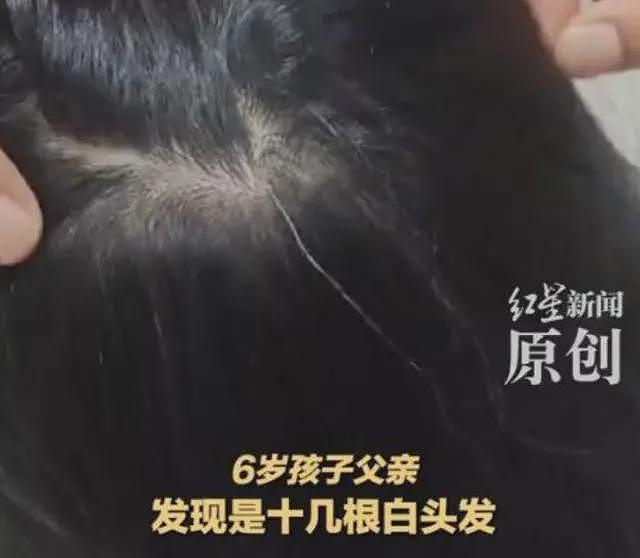 天水幼儿园事件：网友曝光补偿方案，免费入院治疗，区内小学随便挑（组图） - 5