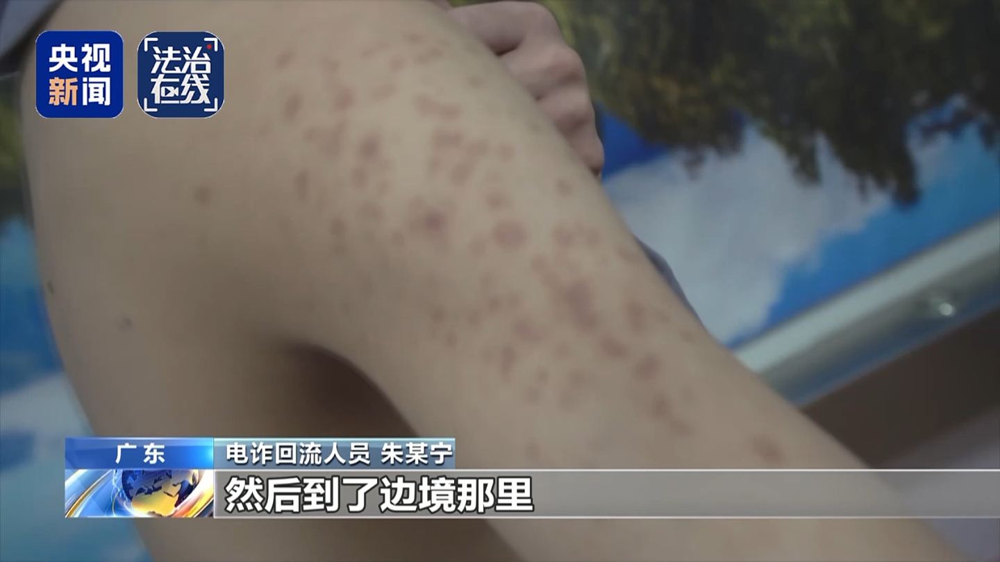 关铁笼、剁手指、强迫卖淫…央视揭缅北白家残忍虐待手段,有一套完整惩戒体系(组图) - 11