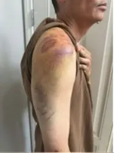 南加华裔联邦探员遭警殴打辱骂“中国来的X“ ，涉事警员被起诉！（组图） - 4