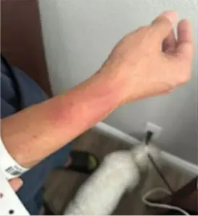 南加华裔联邦探员遭警殴打辱骂“中国来的X“ ，涉事警员被起诉！（组图） - 3
