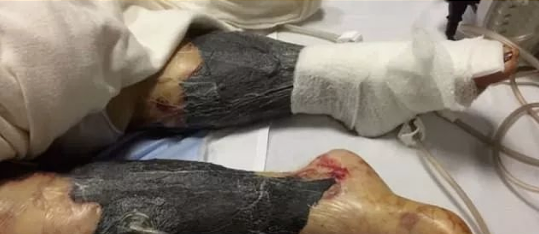 紧急提醒!澳洲鱼类、生蚝全出爆雷,半价都不买!而华人最爱的海鲜,却可以随便抓了吃...(组图) - 22