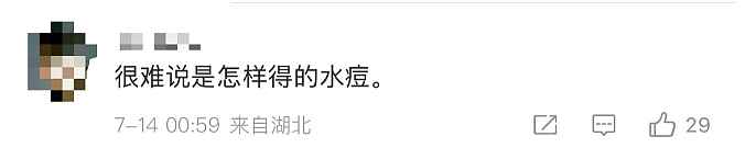 1岁男童突遭女子强搂亲吻，当晚高烧不退、长满红疹！“见面传”严重可致死，妈妈愤怒发声（组图） - 12
