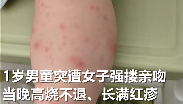 女子街头昏厥,路过男子施救被质疑袭胸?目击者还原事发现场,网友愤怒了(组图) - 8