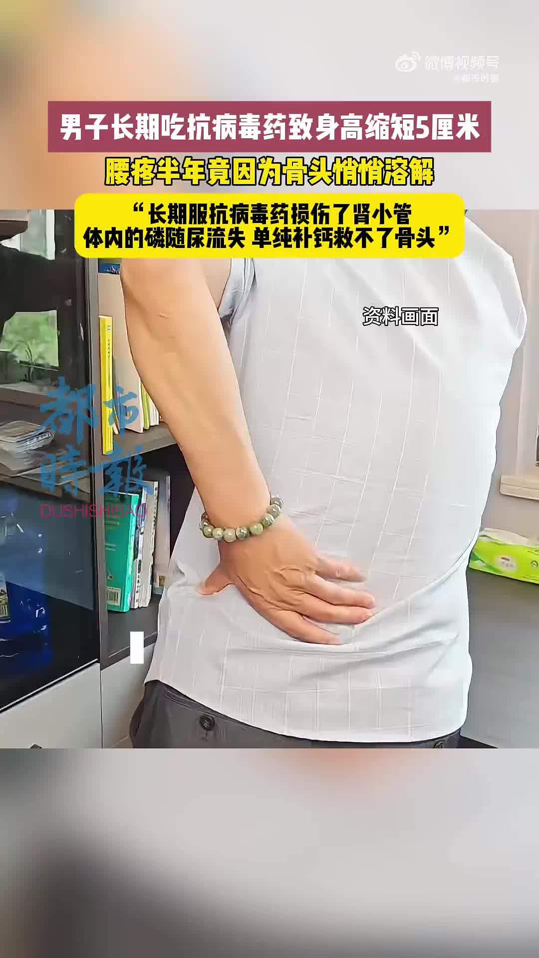 男子长期吃抗病毒药，致身高缩短5厘米（图） - 1