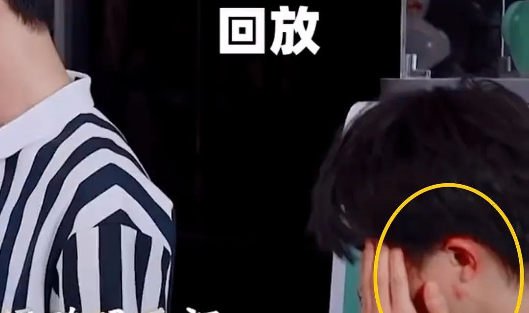 周深录综艺突发意外？本人深夜发文回应（组图） - 4