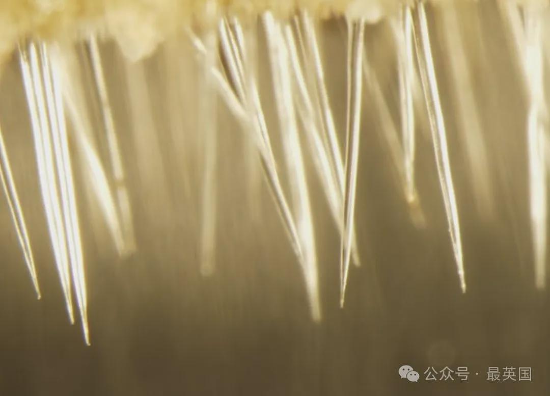 比分娩还痛！澳洲男子误用“全球最毒植物”擦屁屁，疼到举枪自尽！如今竟被英国当宝贝供奉…（组图） - 2