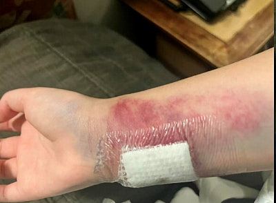 携程旅行团新西兰遇巴士侧翻多伤,团友批未获援助发烧仍继续行程(组图) - 3