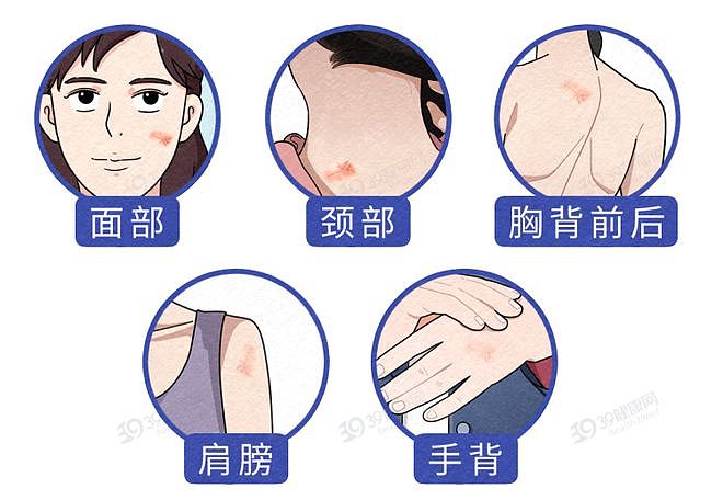 【健康】全球近一半肝癌在中国，提醒：家中的这3种食物，尽早撤下餐桌（组图） - 5