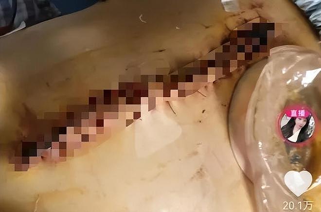 “被家暴16次”女子称前婆婆被撤销上诉，维持一审判决返还91万元，回应身体状况（组图） - 3