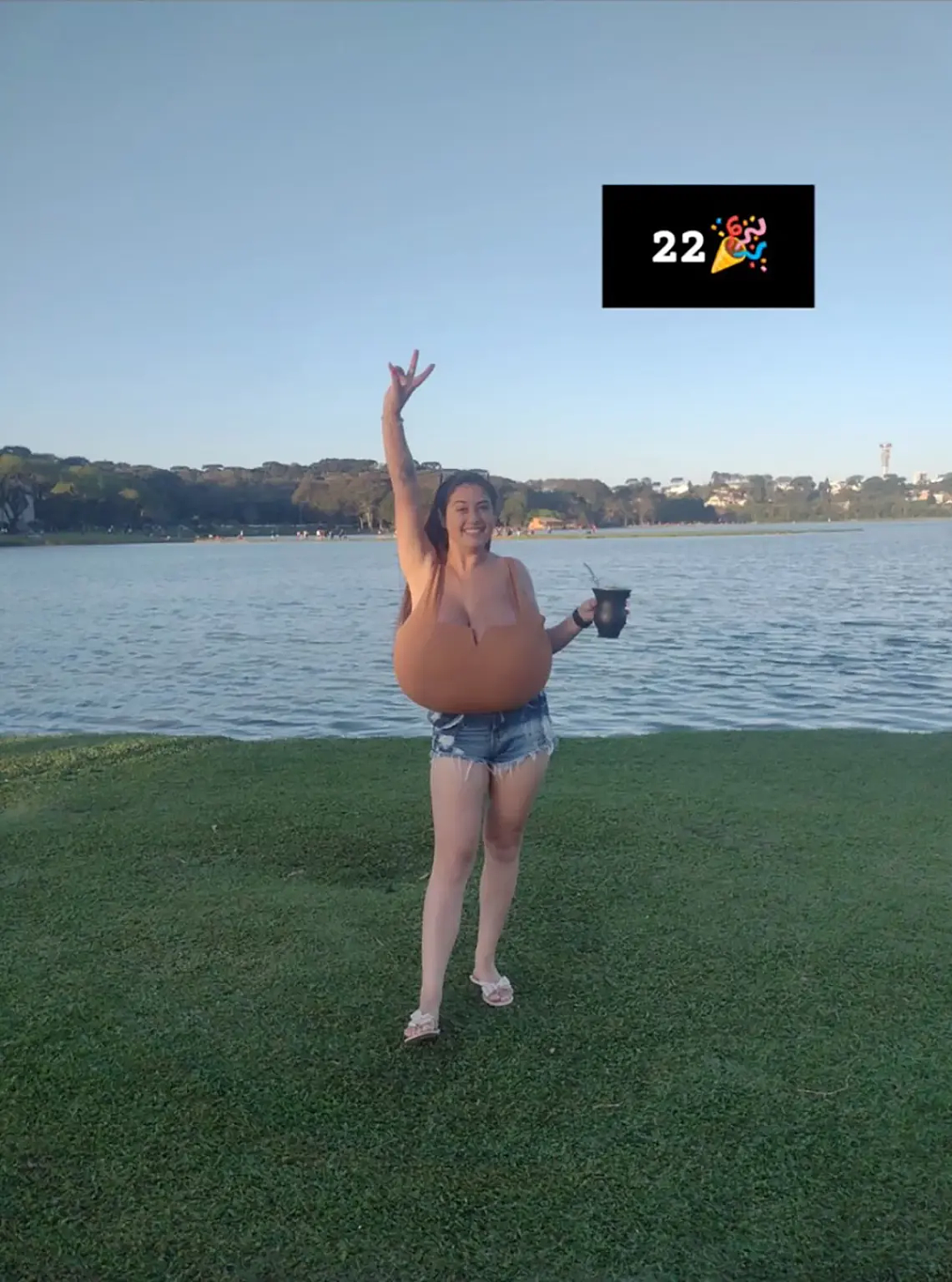 巴西美女得怪病胸部暴涨到24斤？手术10小时切掉20斤，未来可能再长回来（组图） - 6