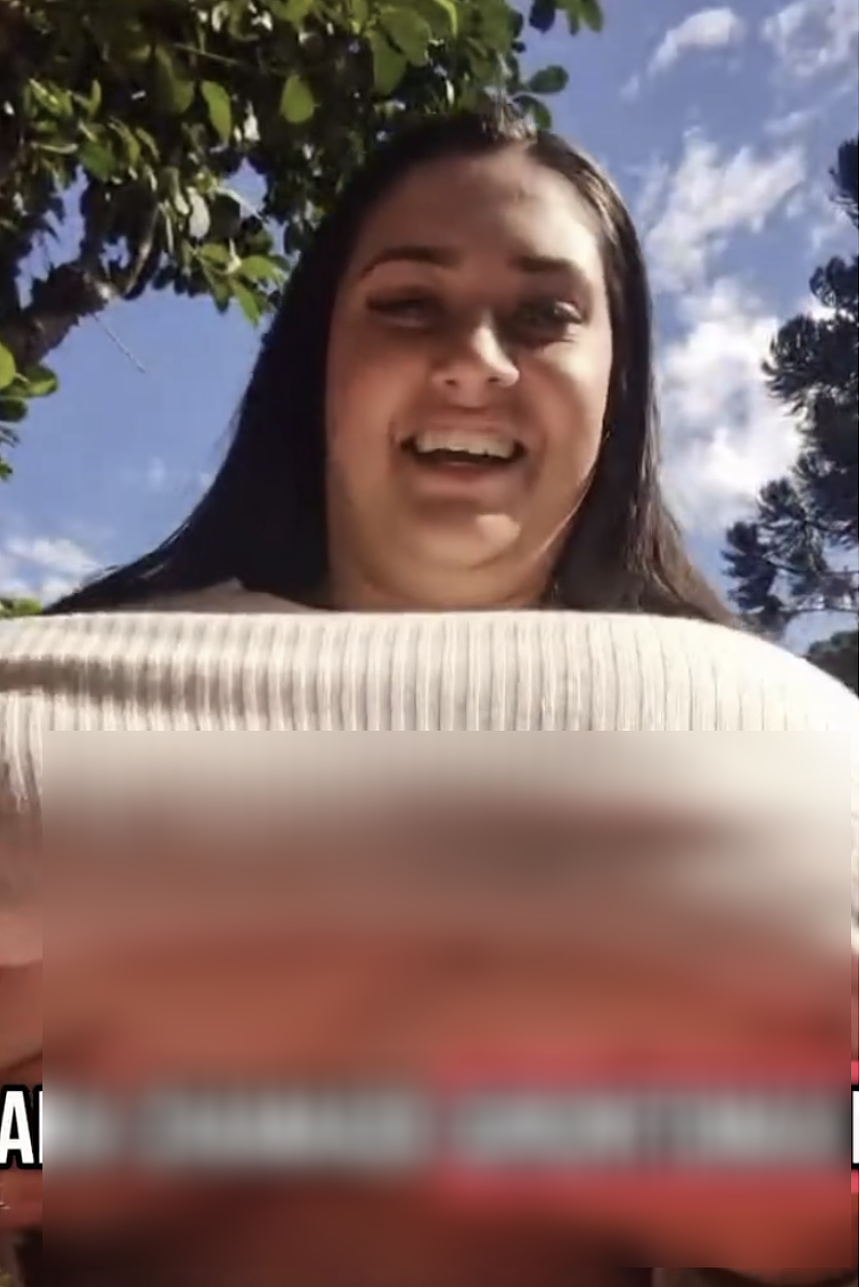巴西美女得怪病胸部暴涨到24斤？手术10小时切掉20斤，未来可能再长回来（组图） - 2