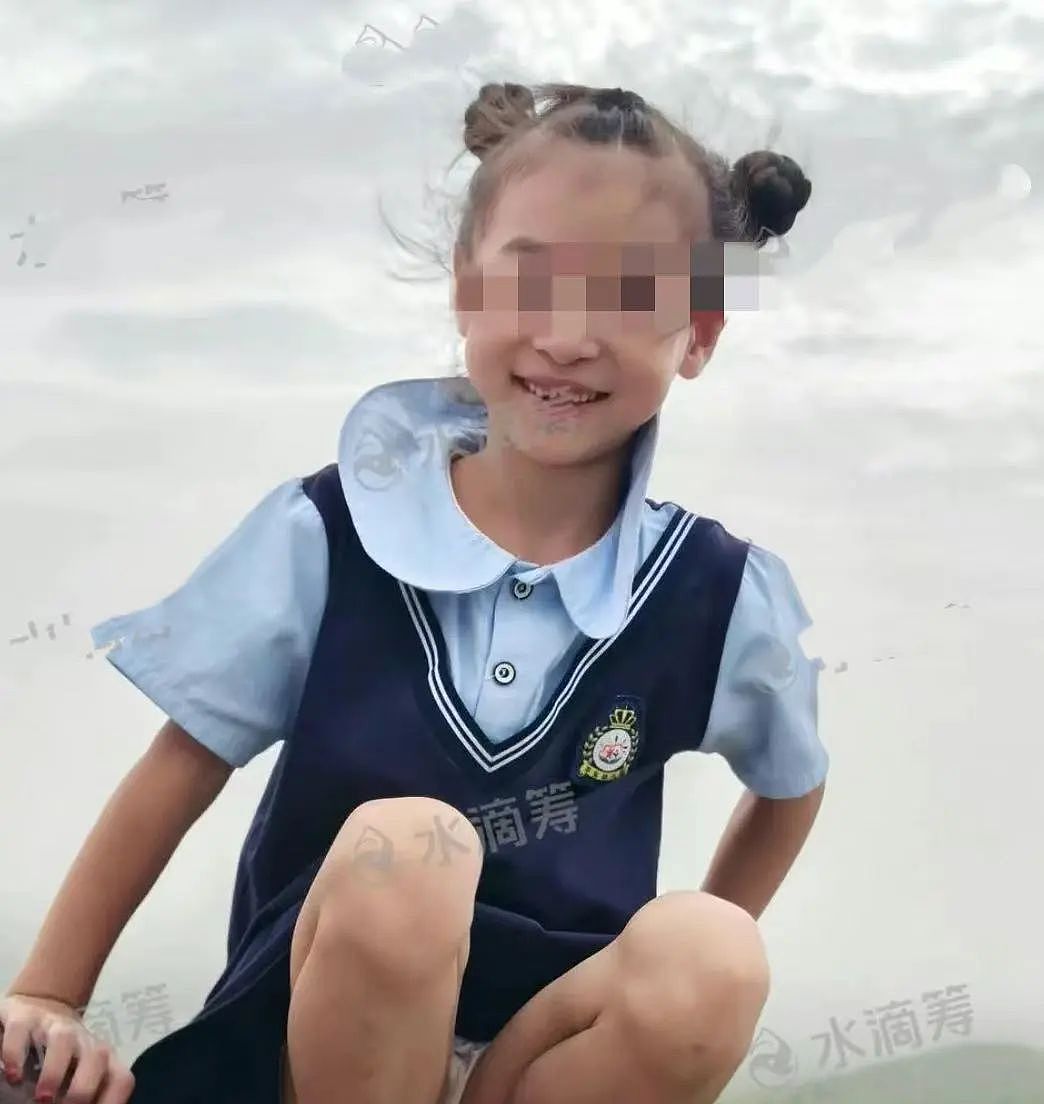 揪心！这场意外爆炸刷屏，女儿手指黏连、妈妈全身85%烧伤！每个家庭警惕（组图） - 2