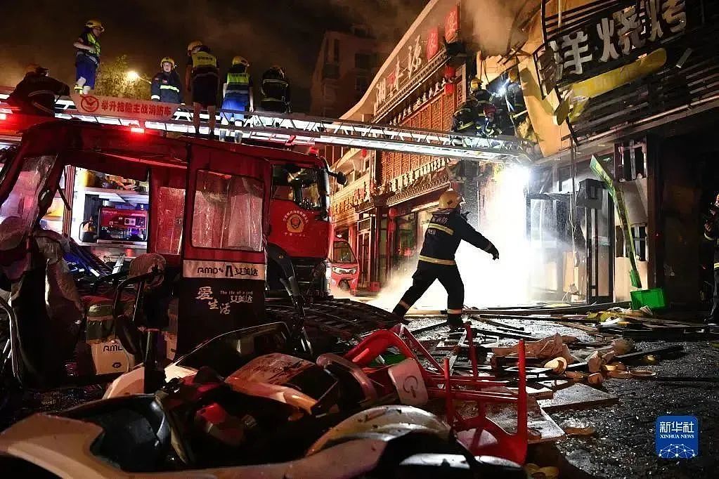 揪心！这场意外爆炸刷屏，女儿手指黏连、妈妈全身85%烧伤！每个家庭警惕（组图） - 8
