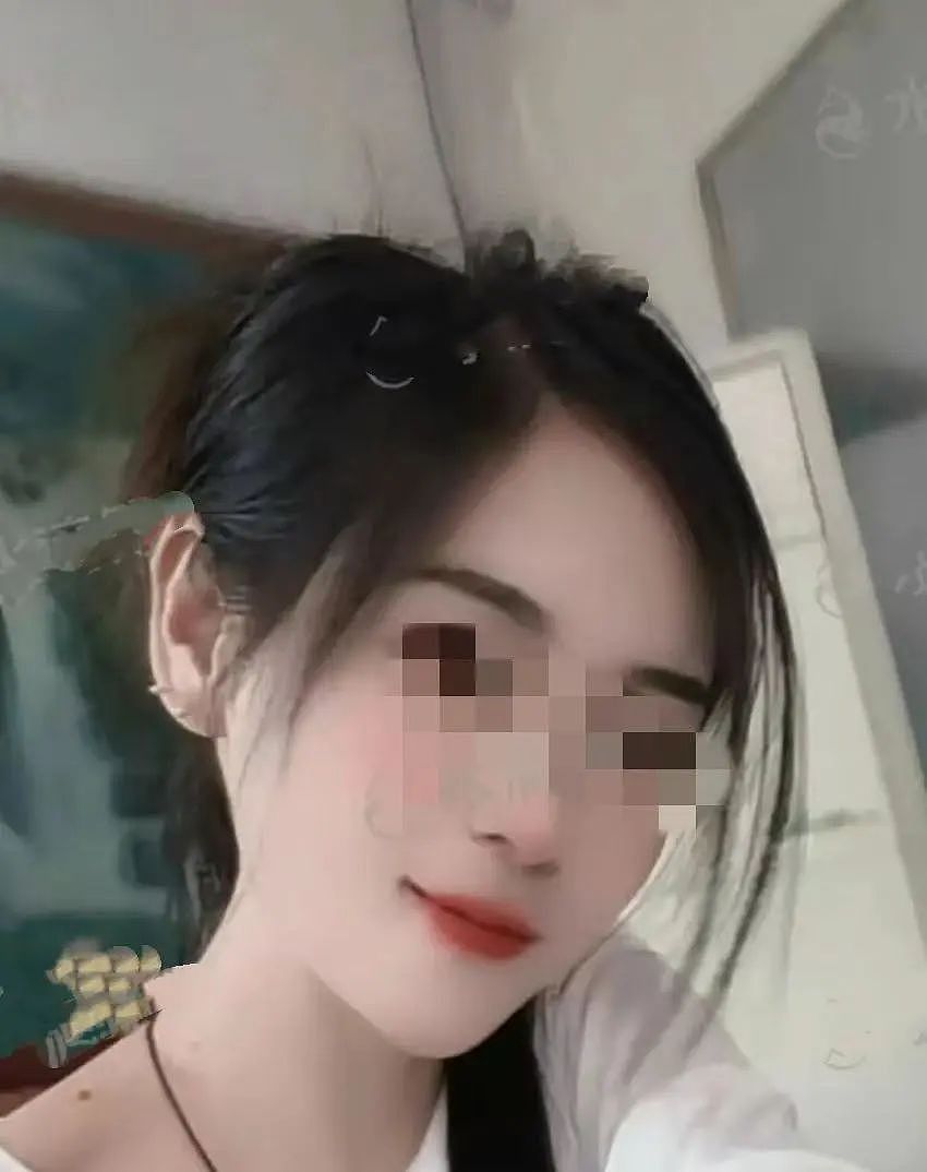 揪心！这场意外爆炸刷屏，女儿手指黏连、妈妈全身85%烧伤！每个家庭警惕（组图） - 4
