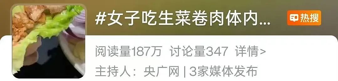 女子反复腹痛,体内取出20厘米活虫!只因爱吃这道美食……这些千万别这么吃,严重可致命(组图) - 2